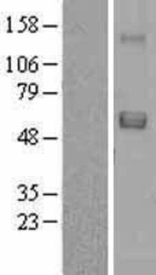 Western Blot: SRPX Overexpression Lysate [NBL1-16458]