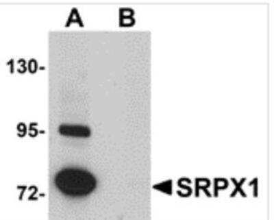 Western Blot: SRPX Antibody Blocking Peptide [NBP1-77086PEP]