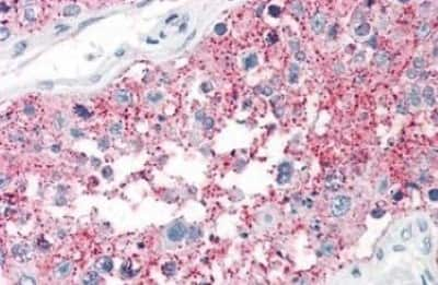 Immunohistochemistry-Paraffin: SRPX2 Antibody [NBP3-14485]