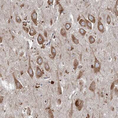 Immunohistochemistry-Paraffin: SRPX2 Antibody [NBP1-86999]