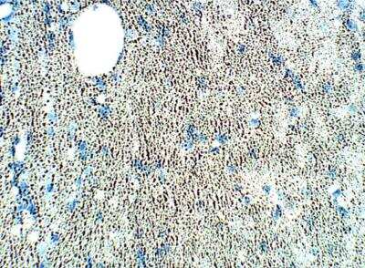 Immunohistochemistry-Paraffin: SRPX2 Antibody [NBP3-12352]