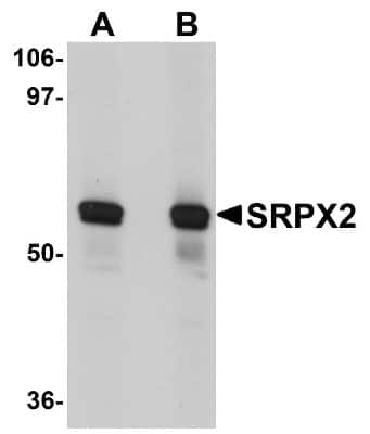 Western Blot: SRPX2 AntibodyBSA Free [NBP1-77370]