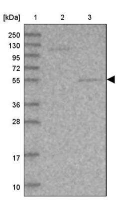 Western Blot: SRPX2 Antibody [NBP1-86999]