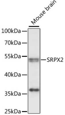 Western Blot: SRPX2 AntibodyAzide and BSA Free [NBP2-94774]