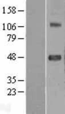 Western Blot: SRPX2 Overexpression Lysate [NBL1-16459]