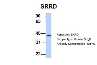 Western Blot: SRRD Antibody [NBP1-70715]