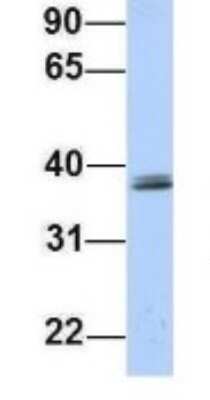 Western Blot: SRRD Antibody [NBP1-70715]