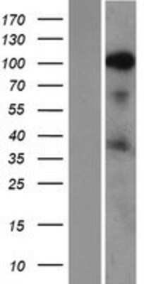 Western Blot: SRRM1 Overexpression Lysate [NBP2-07693]