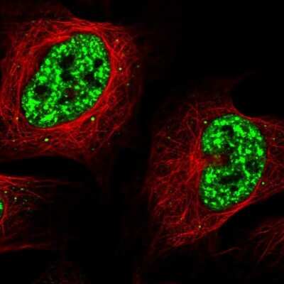 Immunocytochemistry/ Immunofluorescence: SRRM2 Antibody [NBP1-90609]