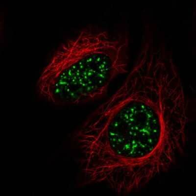 Immunocytochemistry/ Immunofluorescence: SRRM2 Antibody [NBP2-55697]