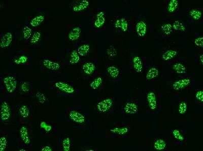 Immunocytochemistry/ Immunofluorescence: SRRM2 Antibody [NBP3-05971]