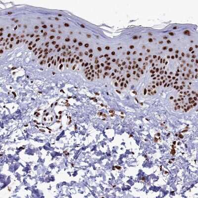 Immunohistochemistry-Paraffin: SRRM2 Antibody [NBP1-90609]