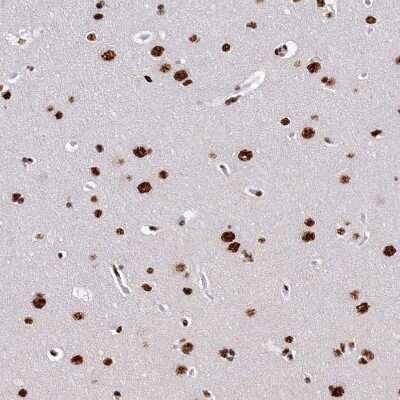 Immunohistochemistry-Paraffin: SRRM2 Antibody [NBP1-90609]