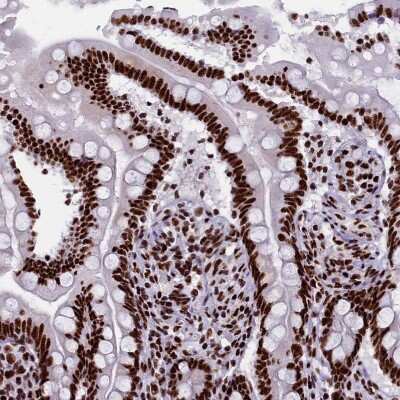 Immunohistochemistry-Paraffin: SRRM2 Antibody [NBP1-90609]