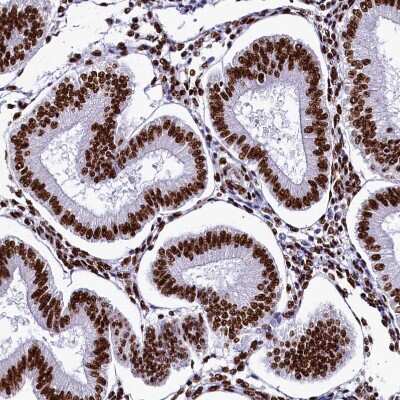 Immunohistochemistry-Paraffin: SRRM2 Antibody [NBP1-90609]