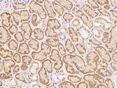 Immunohistochemistry-Paraffin: SRRM4 Antibody [NBP3-06263]