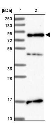 Western Blot: SRRM5 Antibody [NBP1-94187]