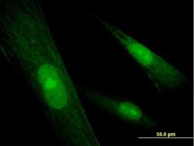 Immunocytochemistry/ Immunofluorescence: SRY Antibody [H00006736-B01P]