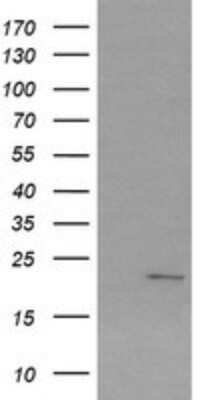 Western Blot: SRY Antibody (OTI3C8)Azide and BSA Free [NBP2-74352]