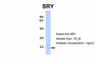 Western Blot: SRY Antibody [NBP2-82349]