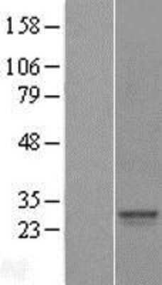 Western Blot: SRY Overexpression Lysate [NBL1-16462]