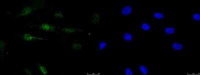 Immunocytochemistry/ Immunofluorescence: SRp55 Antibody [NBP2-04142]