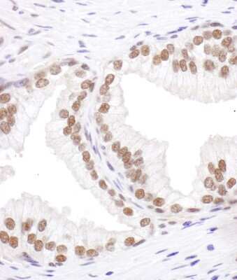Immunohistochemistry-Paraffin: SRp55 Antibody [NBP2-04142]
