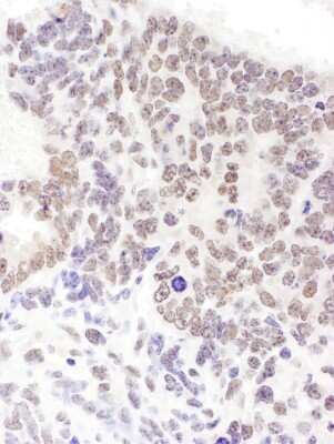 Immunohistochemistry-Paraffin: SRp55 Antibody [NBP2-04142]