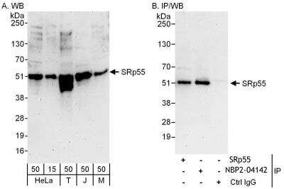 Immunoprecipitation: SRp55 Antibody [NBP2-04142]