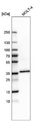 Western Blot: SRp55 Antibody [NBP1-90043]