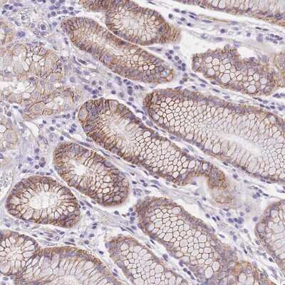 Immunohistochemistry-Paraffin: SRrp35 Antibody [NBP2-13383]