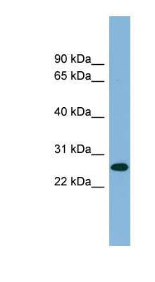 Western Blot: SRrp35 Antibody [NBP1-57405]