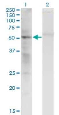 Western Blot: SS18 Antibody (1C8) [H00006760-M07]