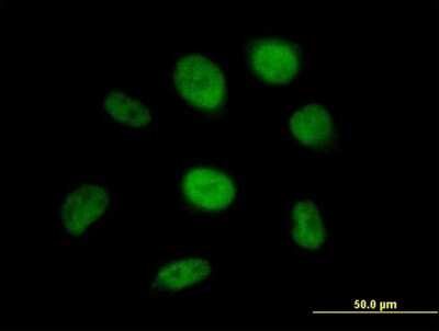 Immunocytochemistry/ Immunofluorescence: SS18 Antibody [H00006760-B01P]