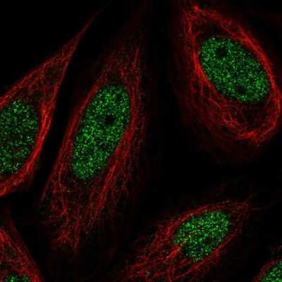 Immunocytochemistry/ Immunofluorescence: SS18 Antibody [NBP2-31777]