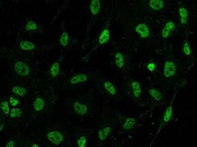 Immunocytochemistry/ Immunofluorescence: SS18 Antibody [NBP2-98476]