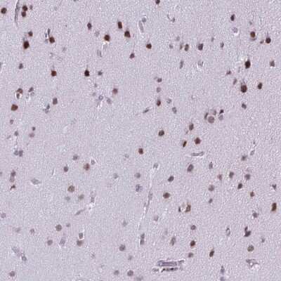 Immunohistochemistry-Paraffin: SS18 Antibody [NBP2-31612]