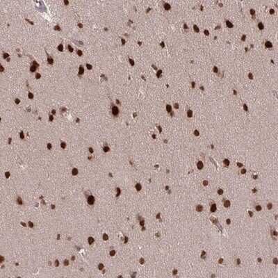 Immunohistochemistry-Paraffin: SS18 Antibody [NBP2-31777]