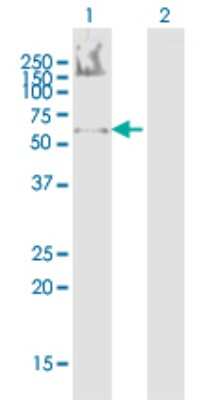 Western Blot: SS18 Antibody [H00006760-B01P]