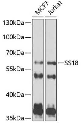 Western Blot: SS18 AntibodyBSA Free [NBP2-95239]