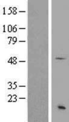 Western Blot: SS18 Overexpression Lysate [NBP2-08819]