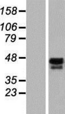 Western Blot: SS18 Overexpression Lysate [NBP2-09819]