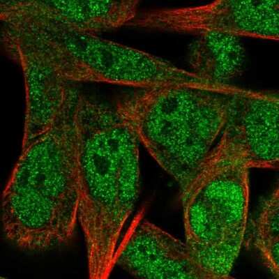 Immunocytochemistry/ Immunofluorescence: SS18L1 Antibody [NBP2-56797]