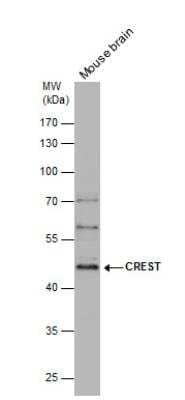 Western Blot: SS18L1 Antibody [NBP2-20485]