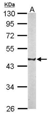 Western Blot: SS18L1 Antibody [NBP2-20486]