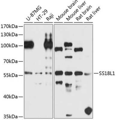 Western Blot: SS18L1 AntibodyBSA Free [NBP2-92997]