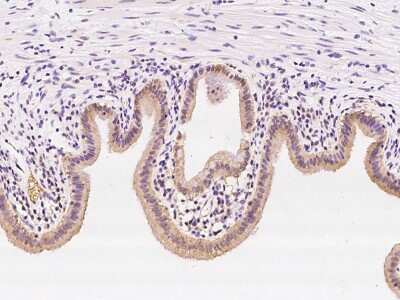 Immunohistochemistry-Paraffin: SS18L2 Antibody [NBP2-98477]