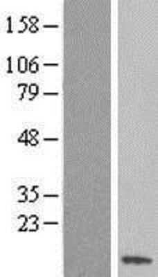 Western Blot: SS18L2 Overexpression Lysate [NBL1-16463]