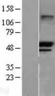 Western Blot: TRIM21/SSA1 Overexpression Lysate [NBL1-17281]