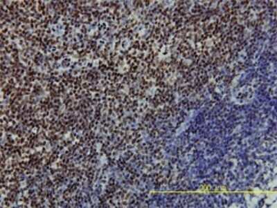 Immunohistochemistry-Paraffin: SSB Antibody (1D6-H5) [H00006741-M01]